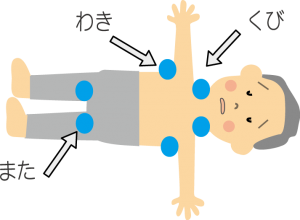 熱中症応急処置冷やす場所