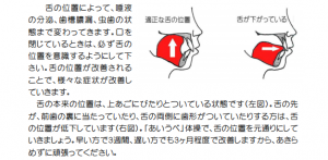 あいうべ~2