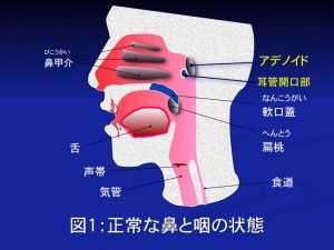 アデノイド1